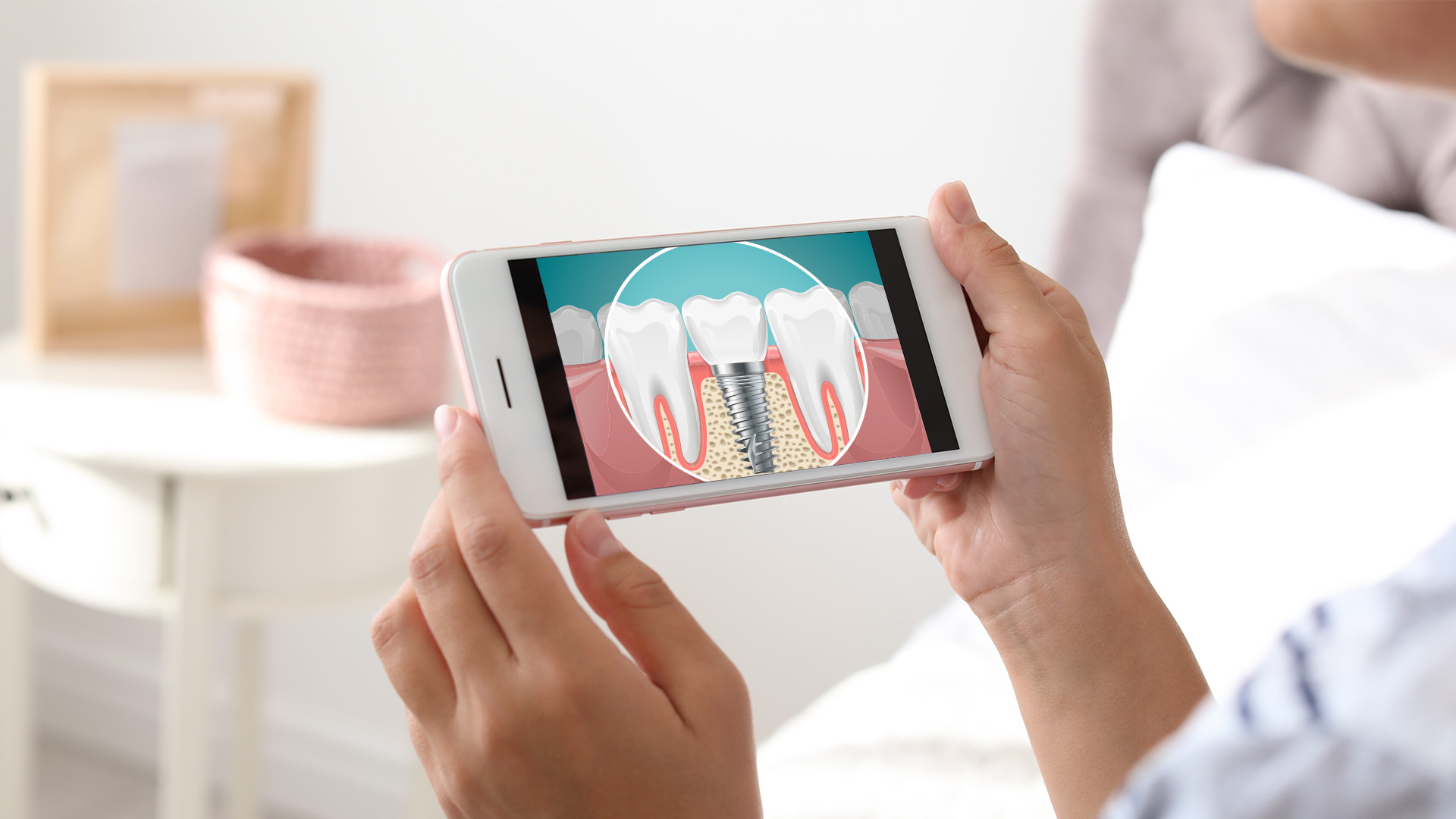 Everyday Dental | Fluoride Treatment, Dental Fillings and Implant Restorations