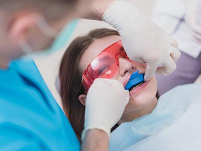 Everyday Dental | Extractions, Fluoride Treatment and Crowns