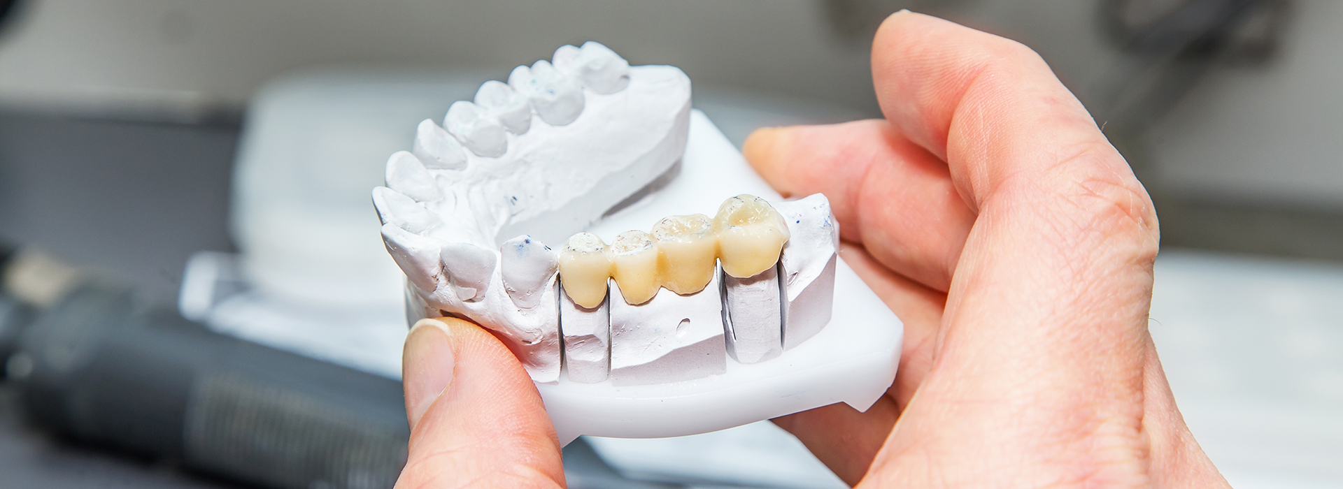 Everyday Dental | Dentures, Oral Exams and Oral Cancer Screening
