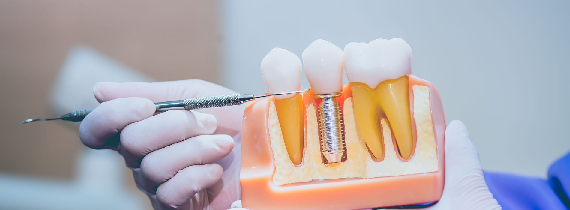 Everyday Dental | Emergency Treatment, Preventative Program and Dental Fillings