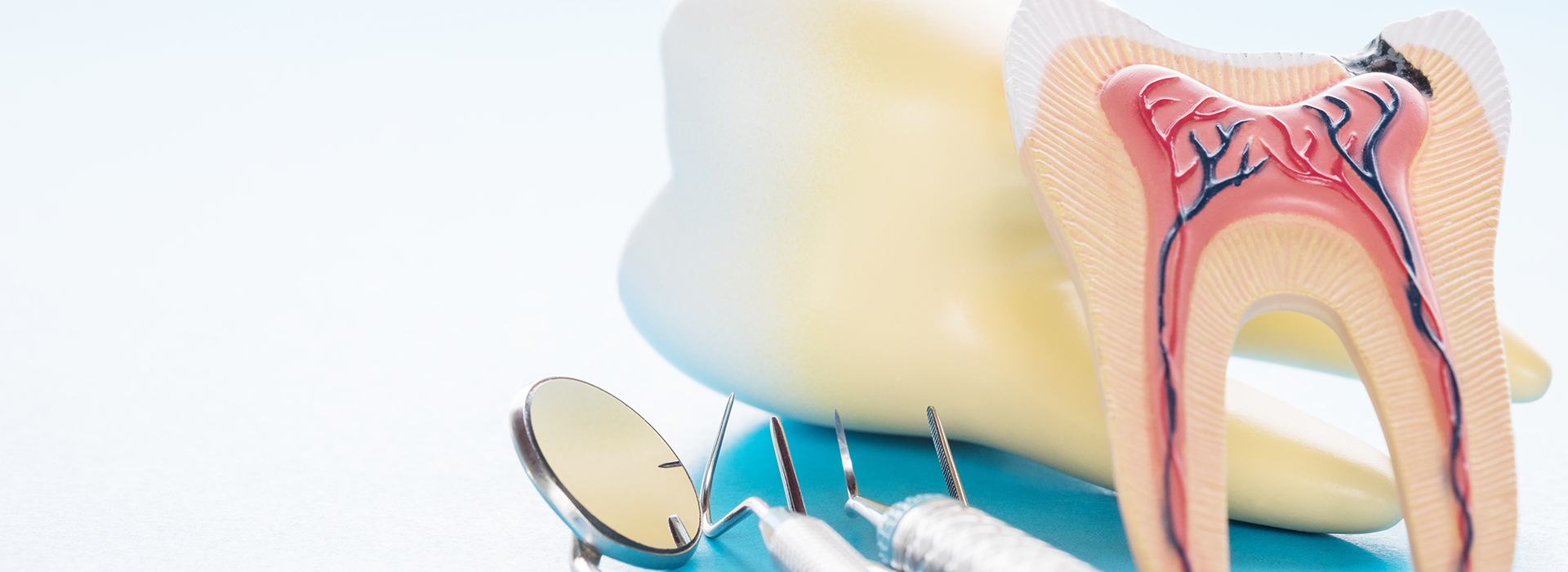 Everyday Dental | Dental Bridges, Fluoride Treatment and Root Canals